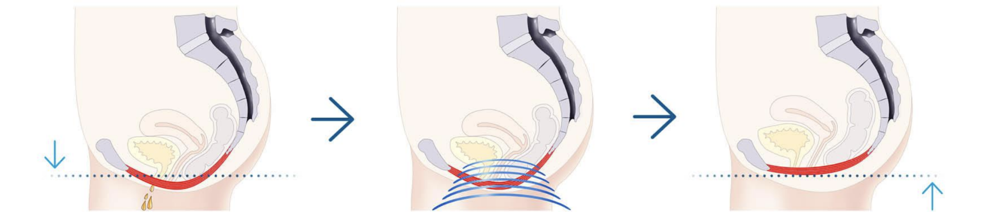 Before treatment, during treatment, after treatment